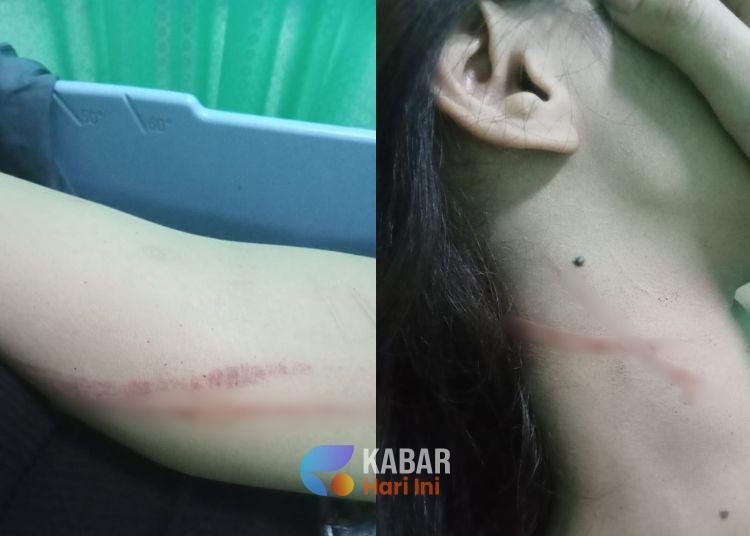 LC Karaoke di Batang Diduga Jadi Korban Penganiayaan, Pengunjung Dilaporkan Polisi 1 batang 1